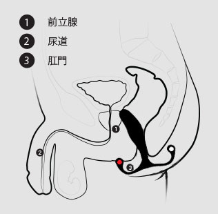 MGX挿入断面図