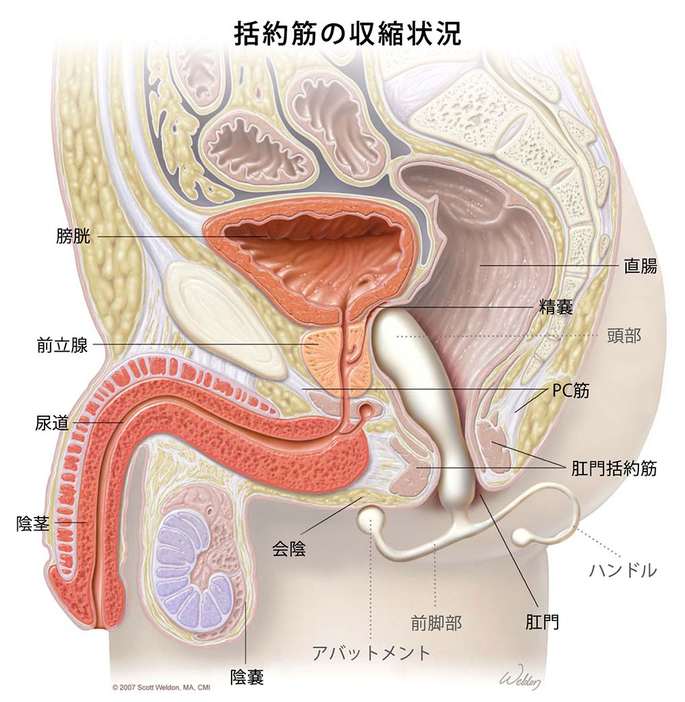 アネロスが挿入された男性の断面図