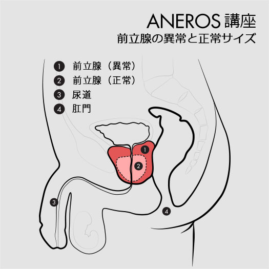 前立腺の異常と正常サイズ